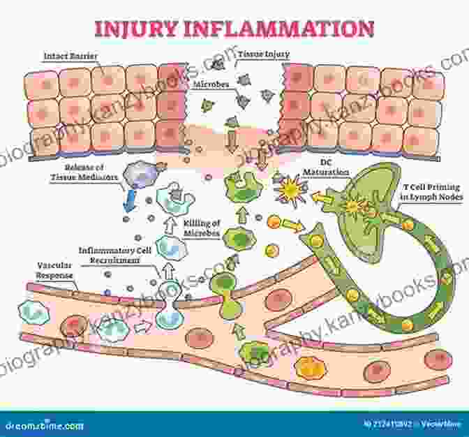 Diagram Illustrating The Inflammatory Process Crohn S Disease Cookbook: A Healthy Meal Diet Recipes To Heal Inflammation Pain And Fatigue