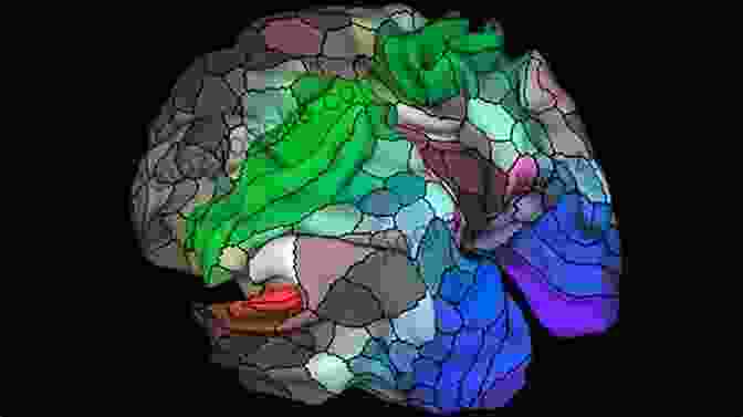 Network Architecture Of The Human Brain, Revealing The Interconnectedness Of Its Regions. Epilepsy Surgery: The Network Approach An Issue Of Neurosurgery Clinics Of North America E (The Clinics: Surgery)