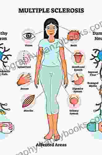 Multiple Sclerosis Prognosis: Multiple Sclerosis Causes: Multiple Sclerosis Foundation