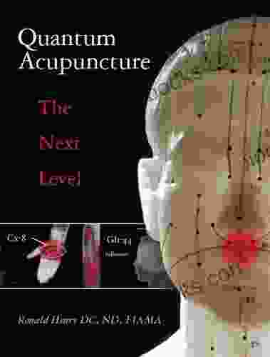 Quantum Acupuncture The Next Level