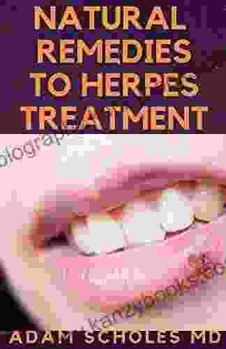 NATURAL REMEDIES TO HERPES TREATMENT: The Complete Guide On Treating Herbs Naturally